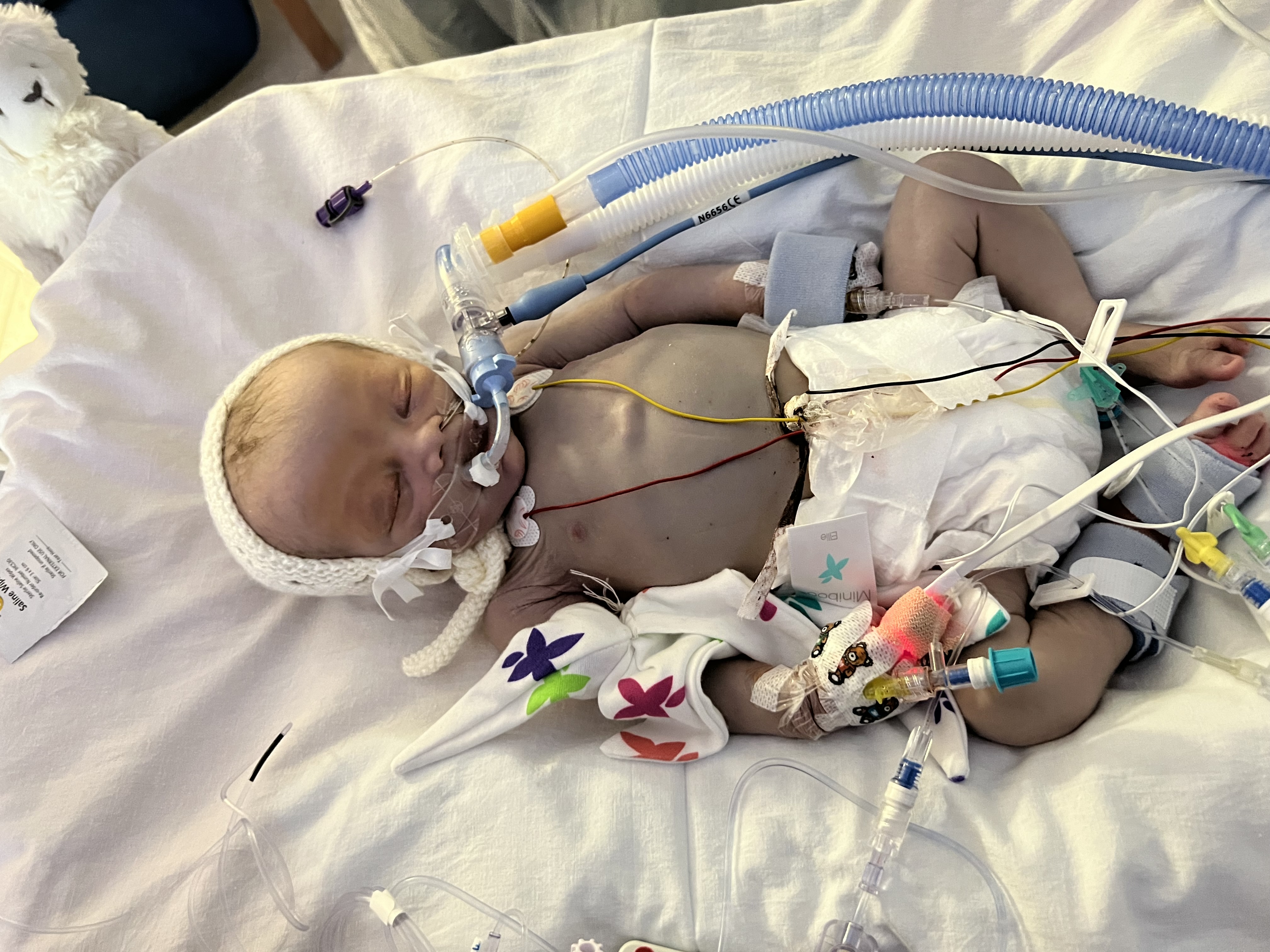Austin in NICU